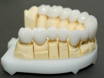 стоимость керамического зуба 