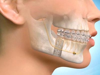 Наука ортодонтия