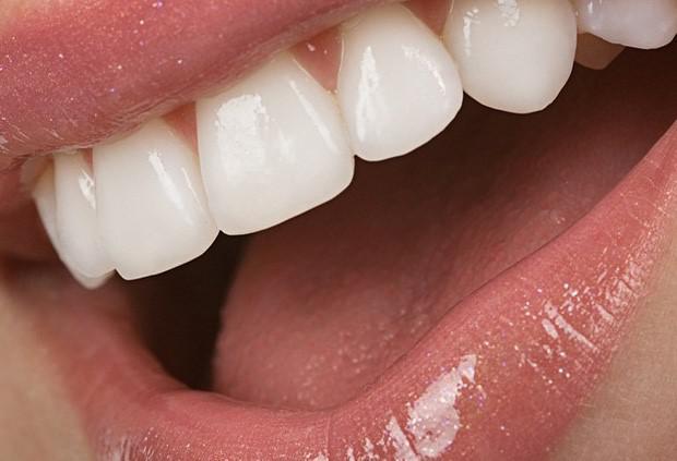 Можно ли укрепить эмаль зубов? Причины повреждения эмали зубов.
