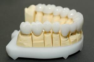 стоимость керамического зуба 