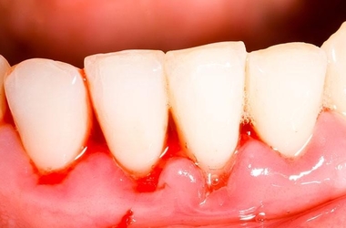 Клиника лечения зубов