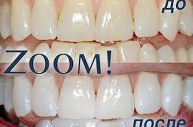 Отбеливание зубов Zoom 3